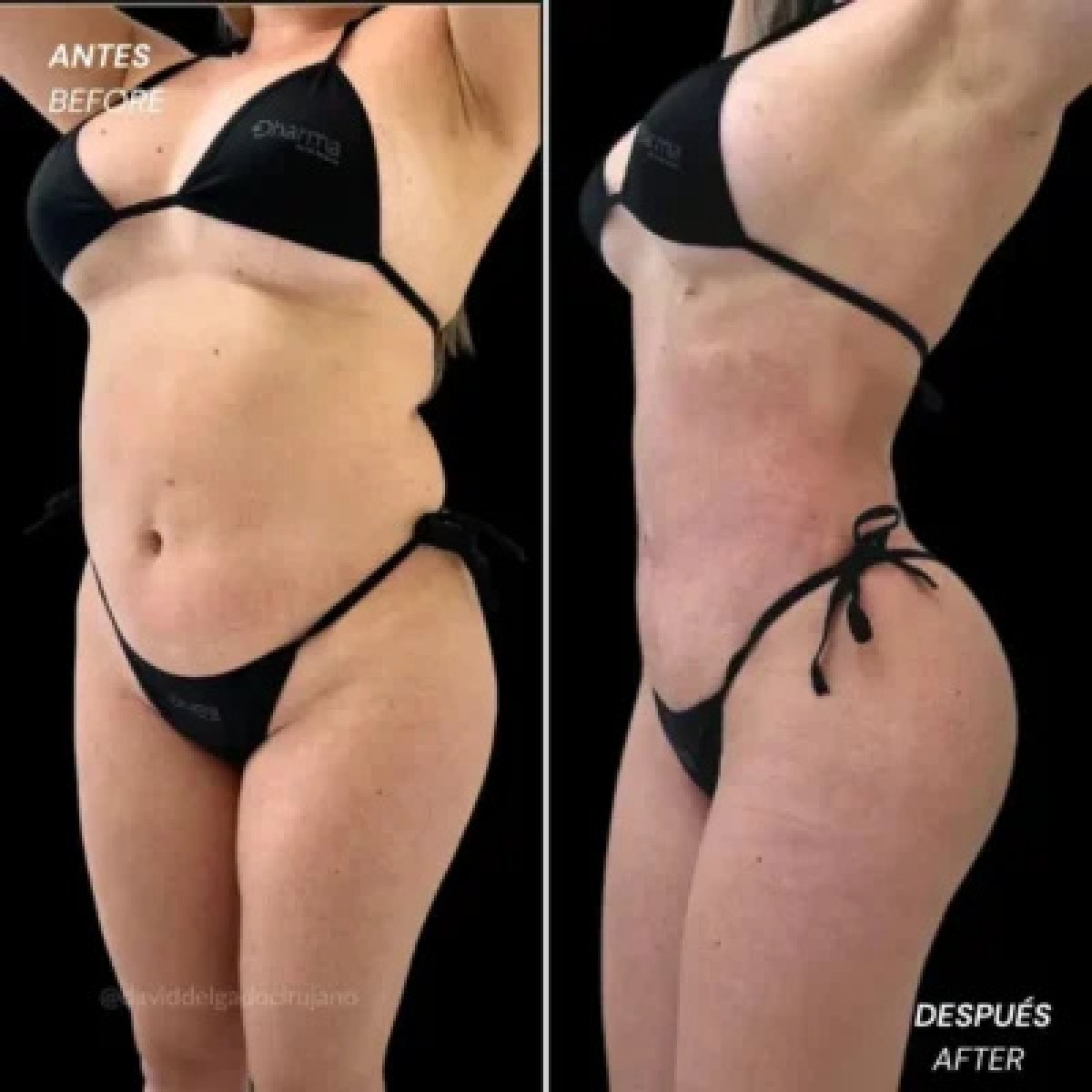 before and after photo