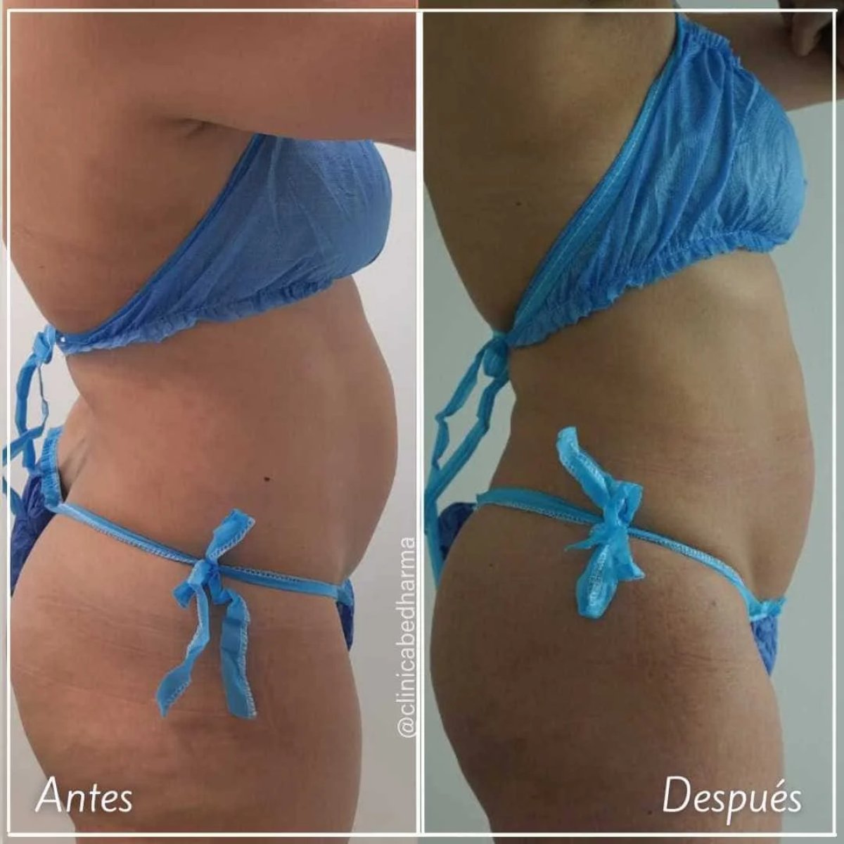 before and after photo