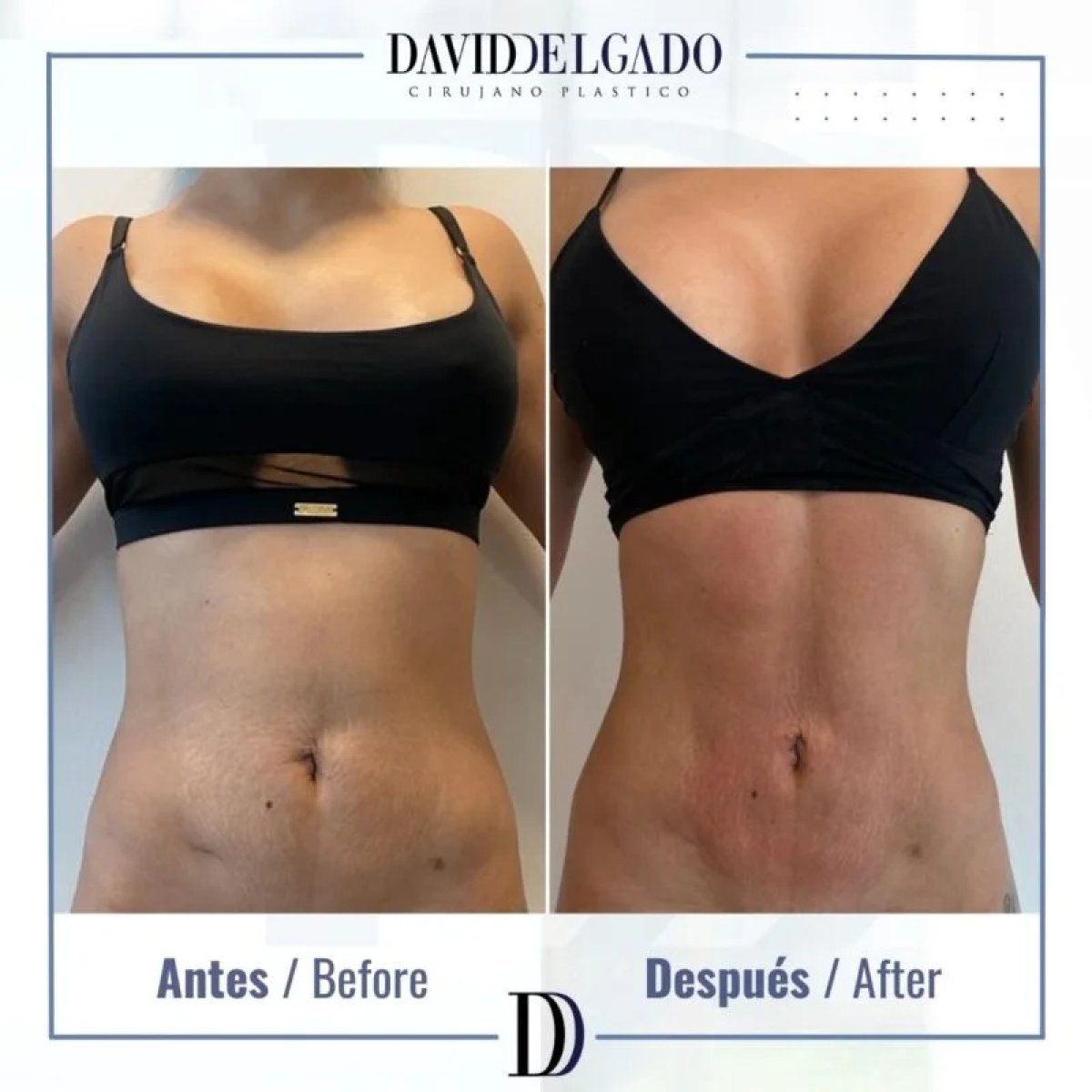 before and after photo