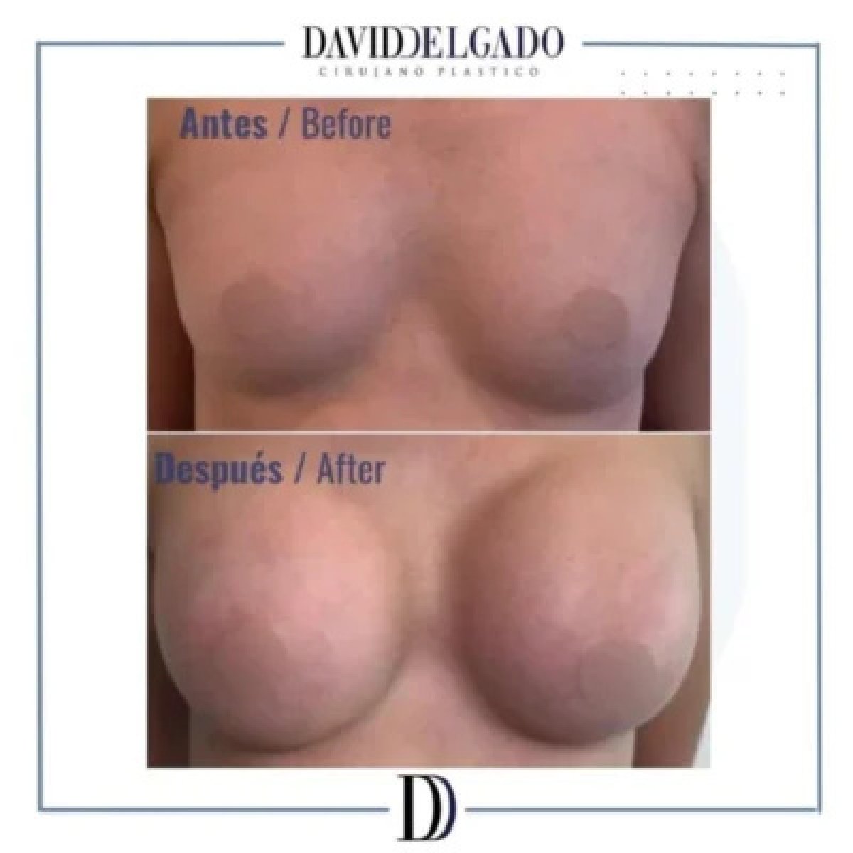 before and after photo