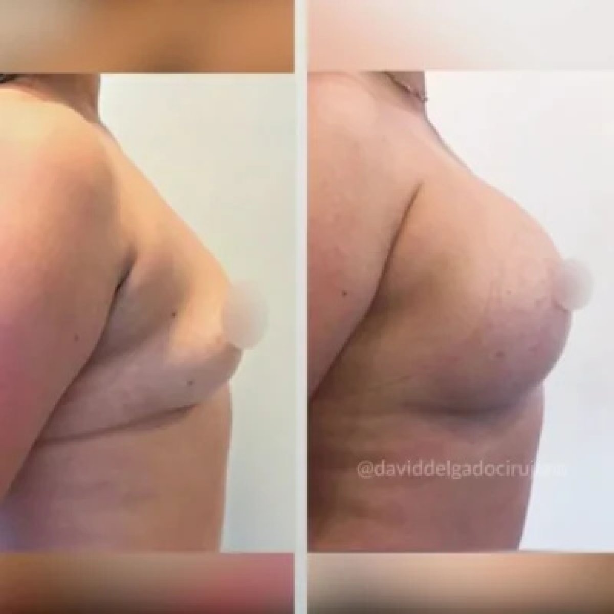 before and after photo