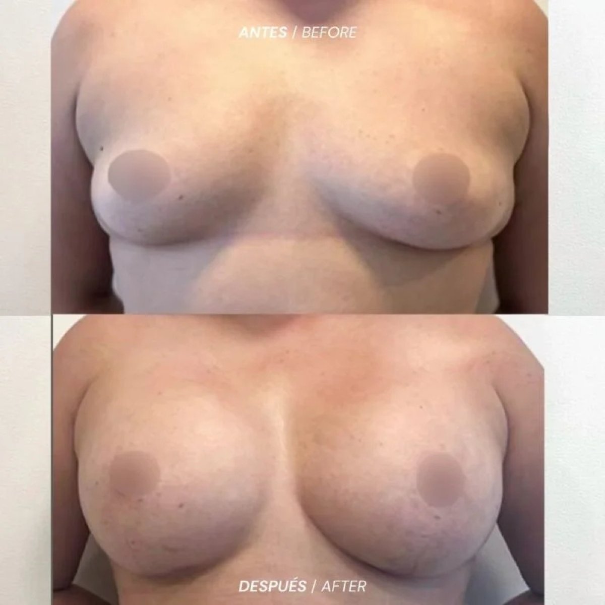 before and after photo