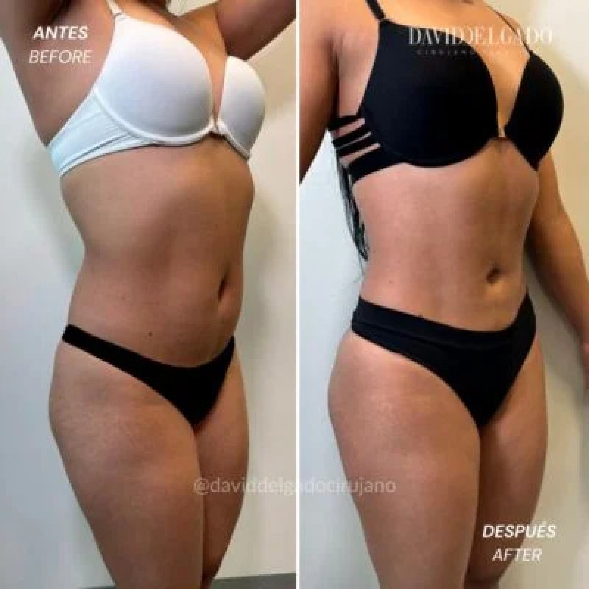before and after photo