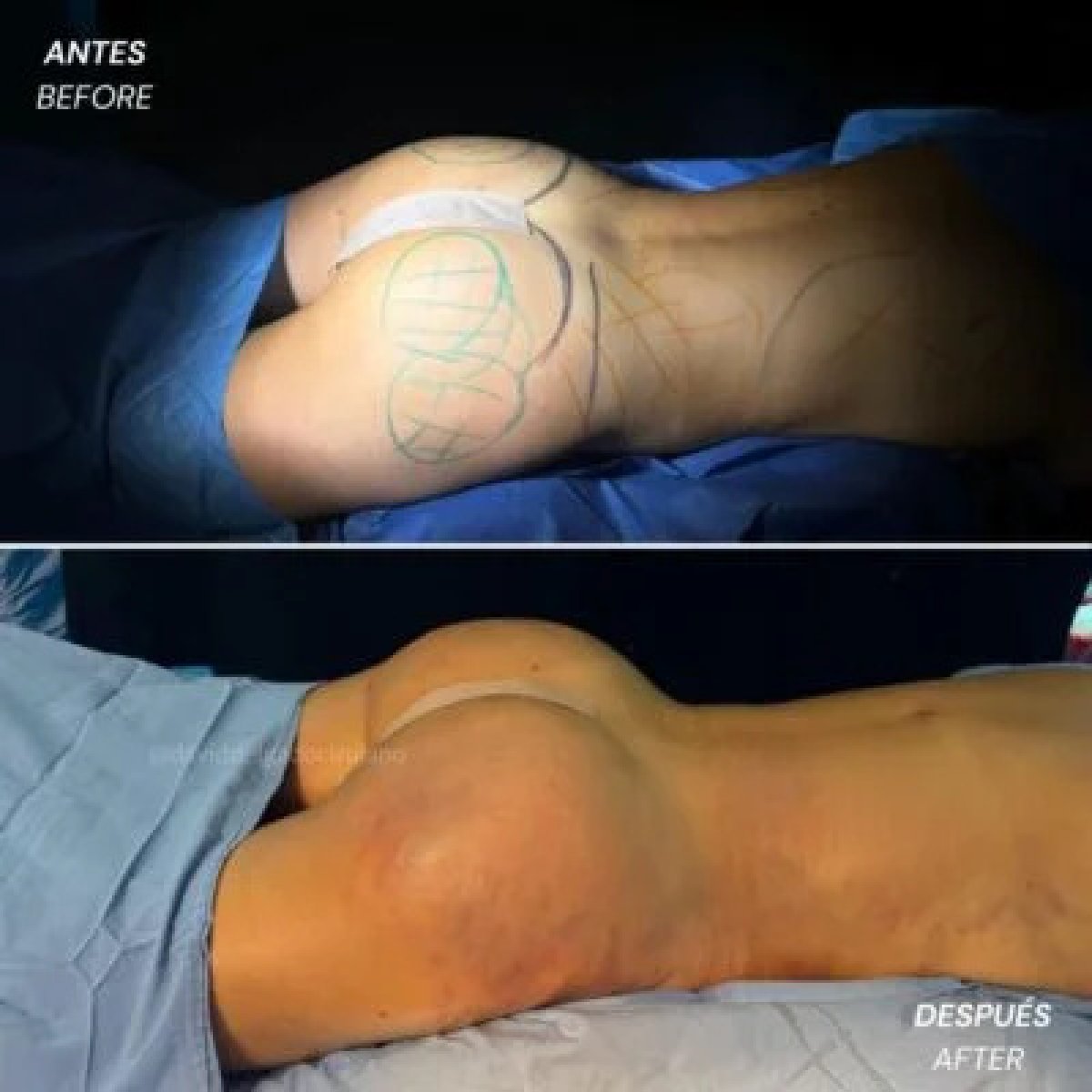 before and after photo