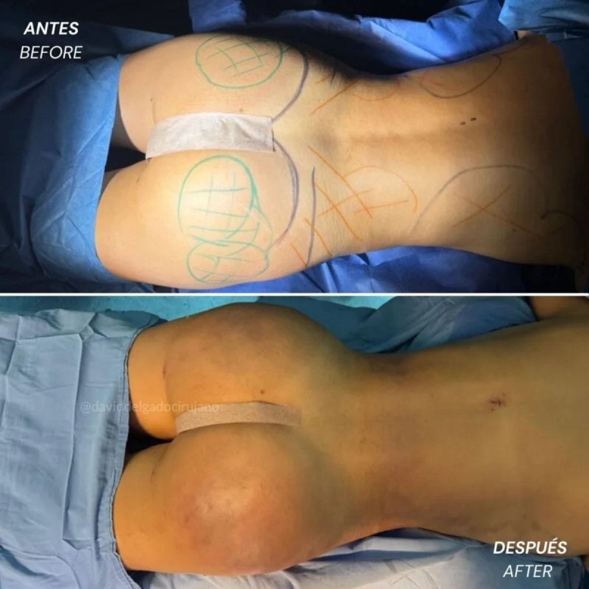 before and after photo