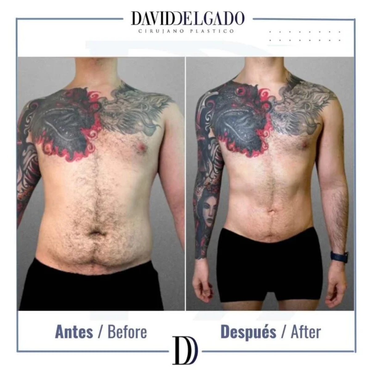before and after photo