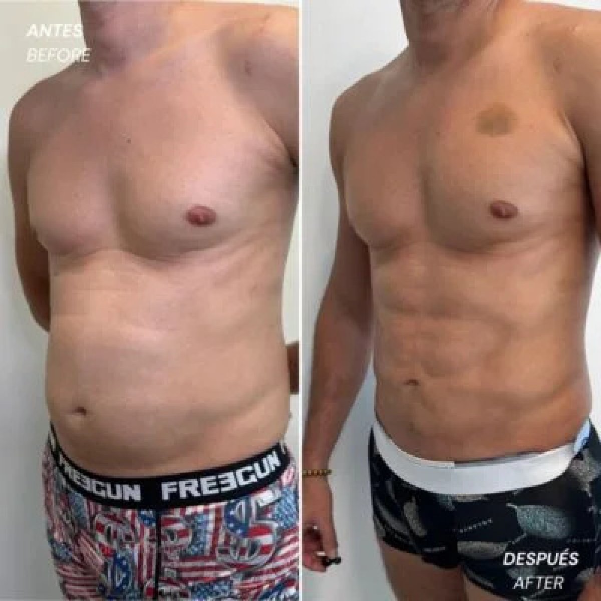 before and after photo