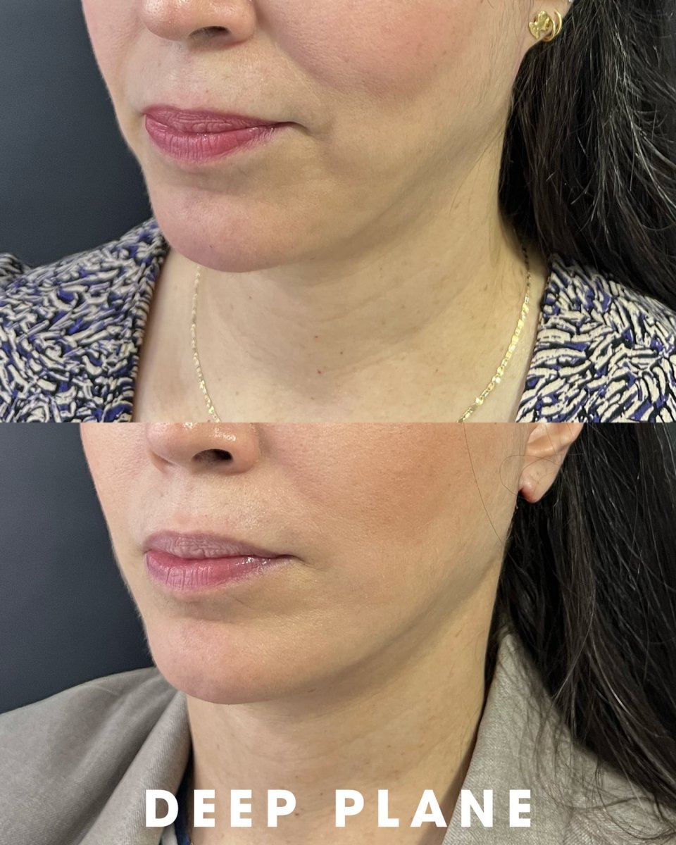 before and after photo