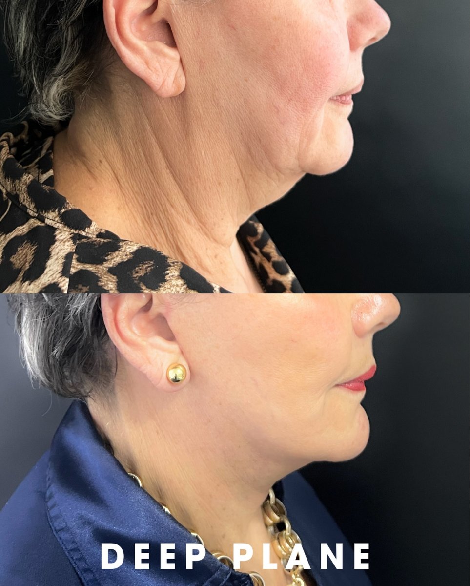 before and after photo
