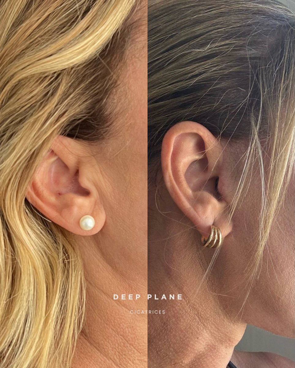 before and after photo