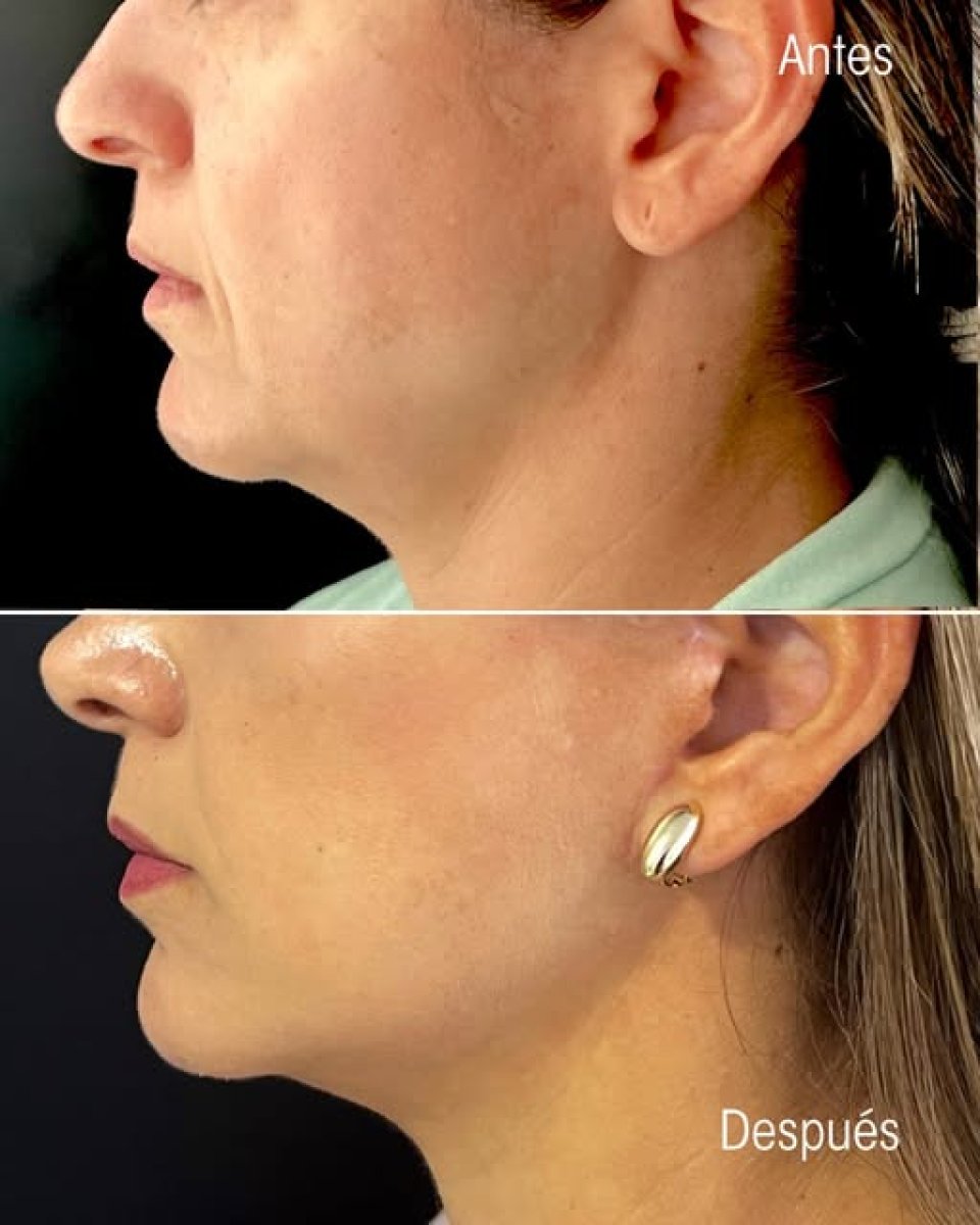 before and after photo