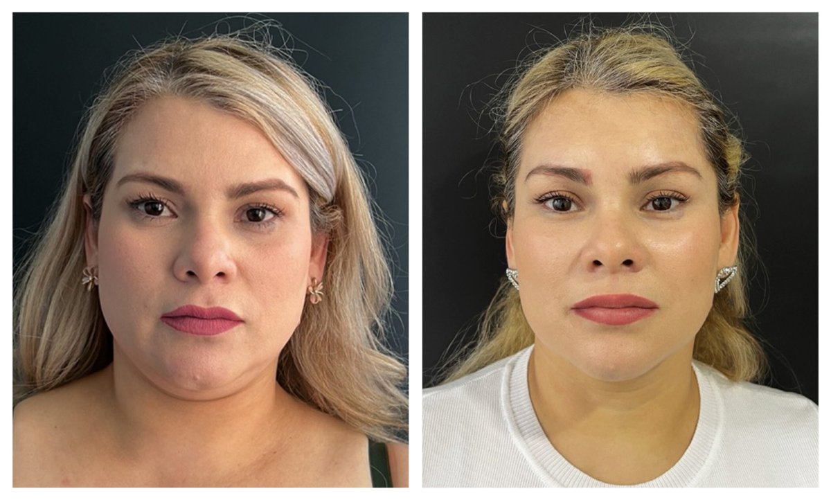 before and after photo