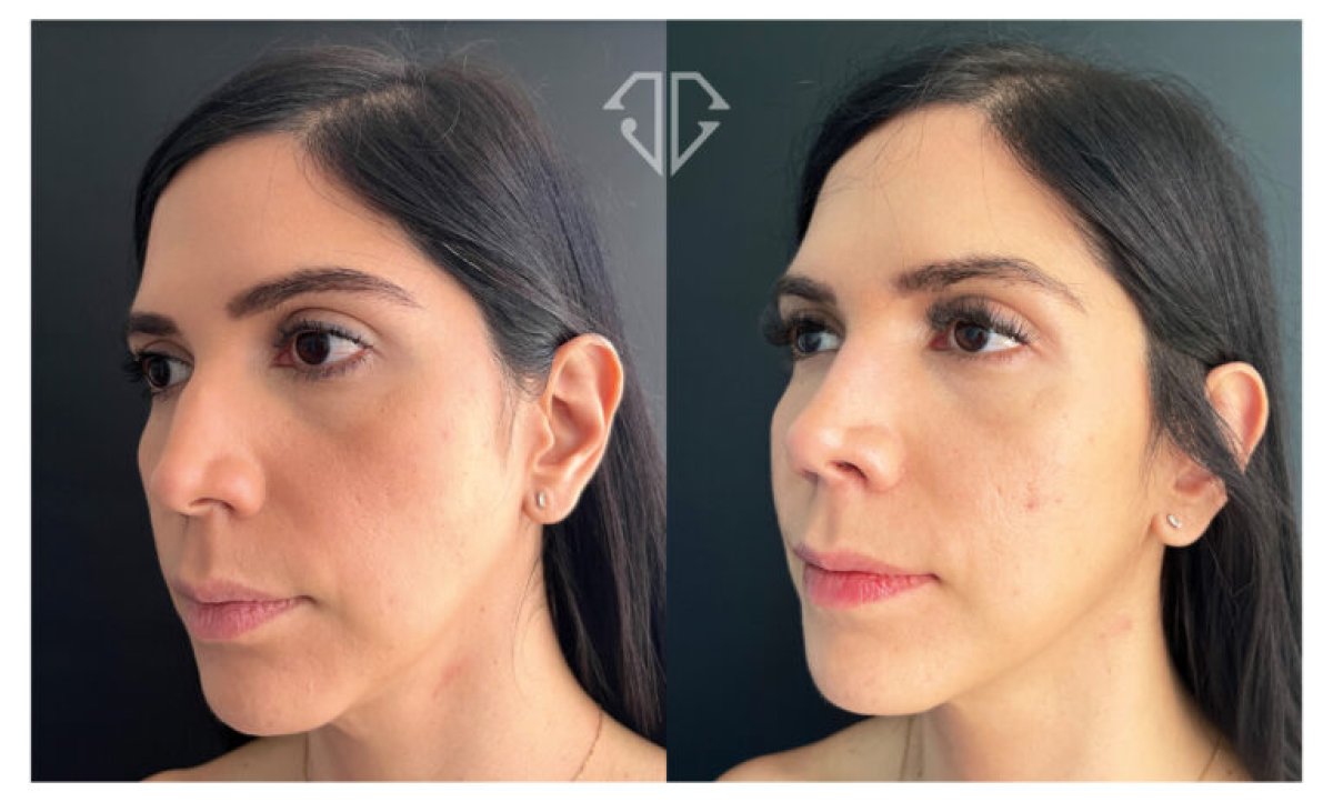 before and after photo