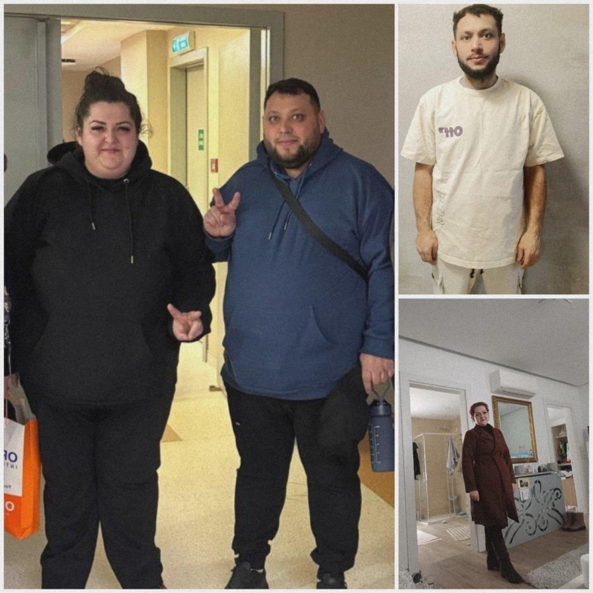 Résultats avant et après sleeve gastrectomie à Optimed International Hospital, perte de poids