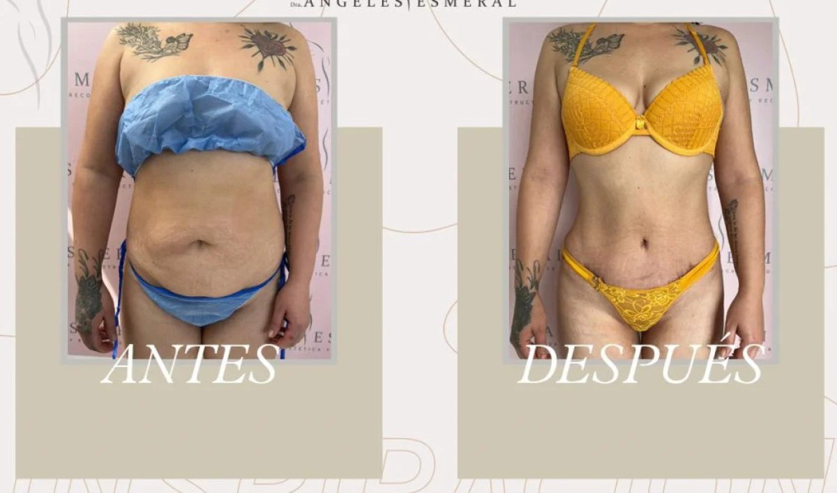 before and after photo