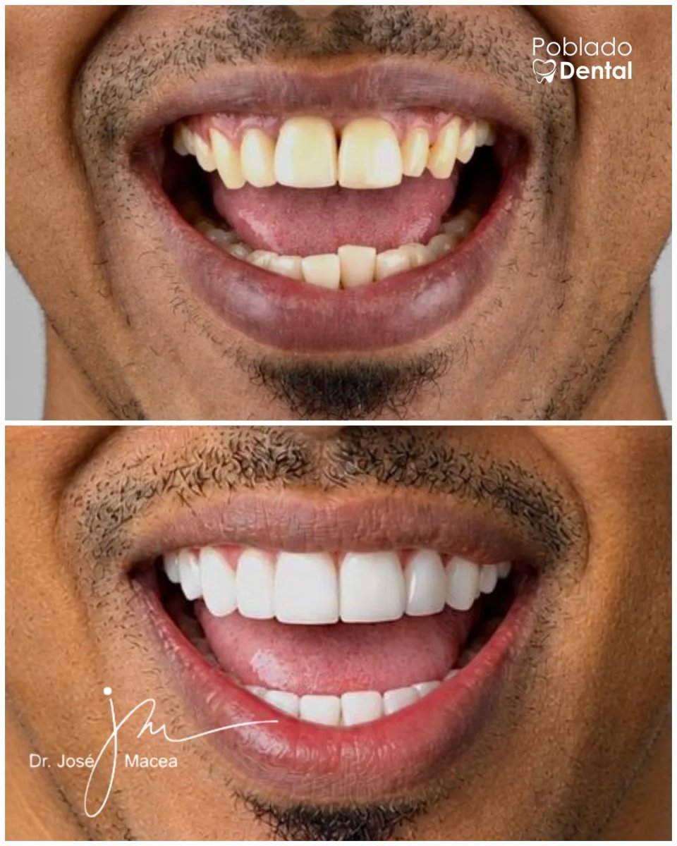 before and after photo