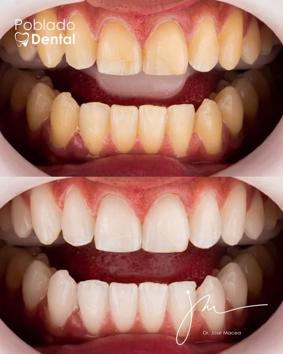 before and after photo