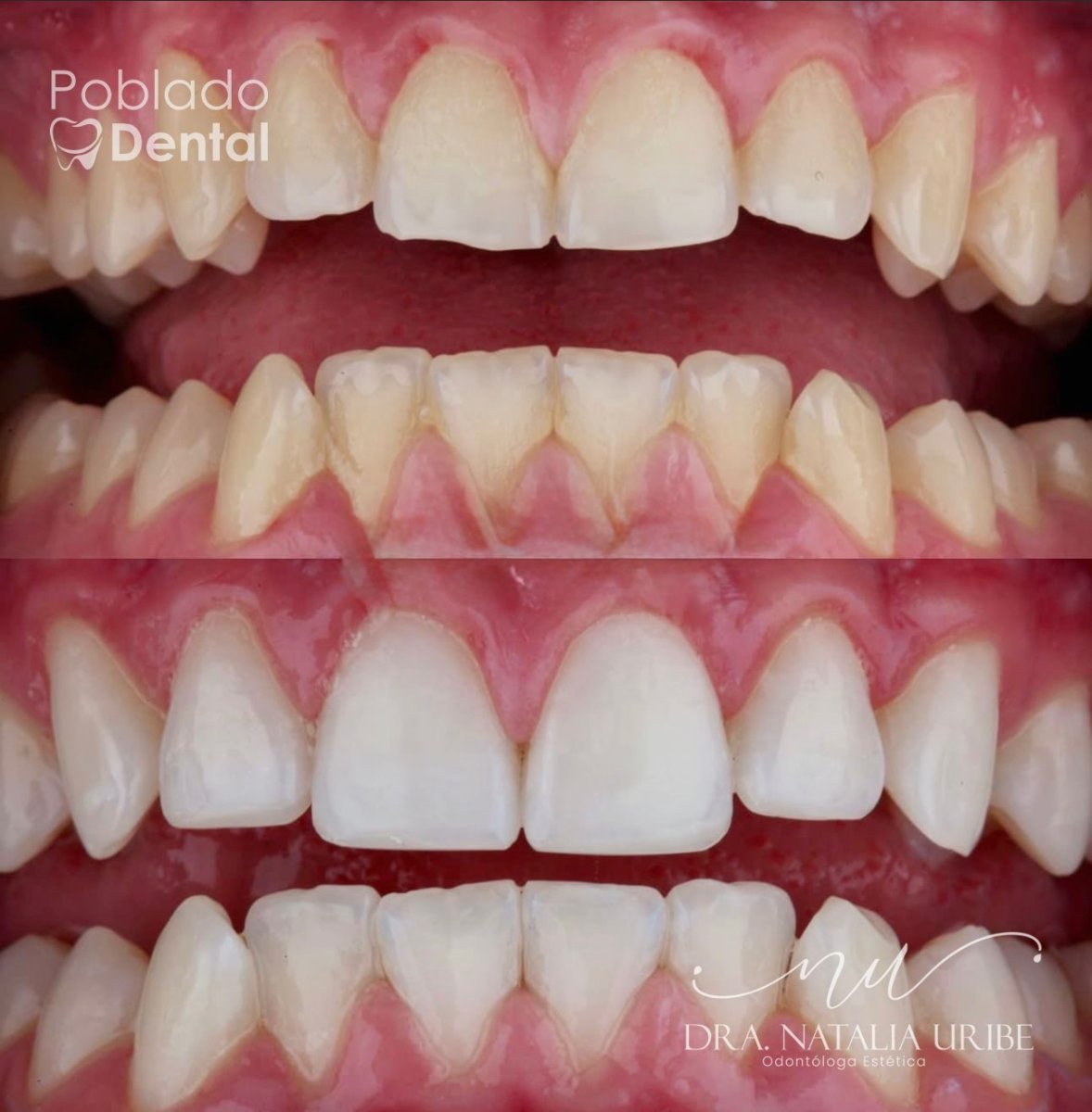 before and after photo