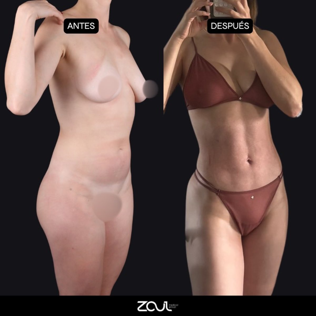 before and after photo