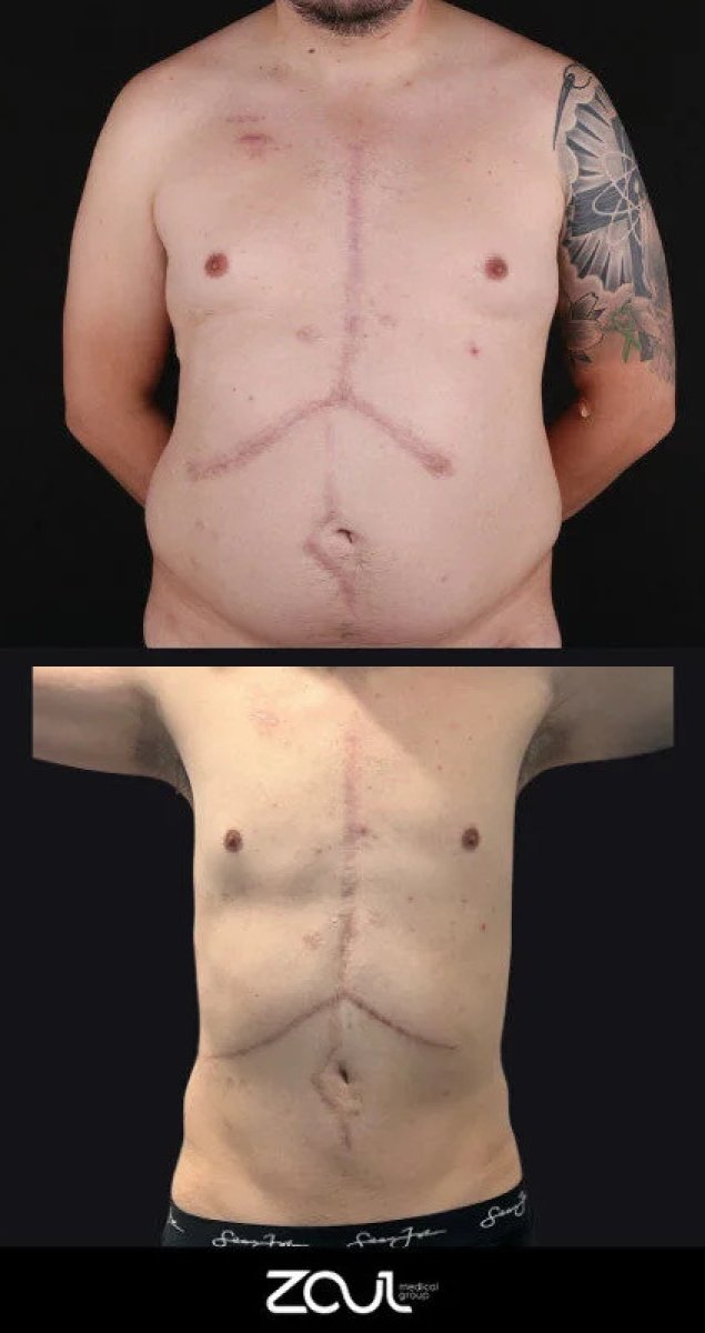 before and after photo