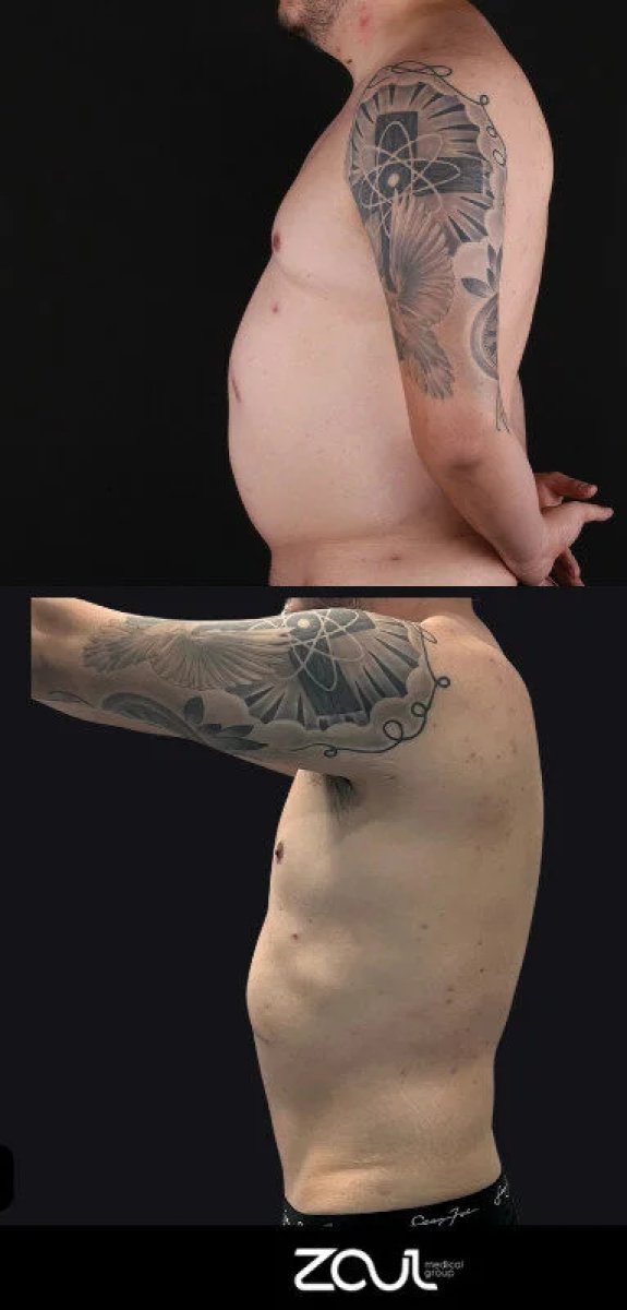 before and after photo