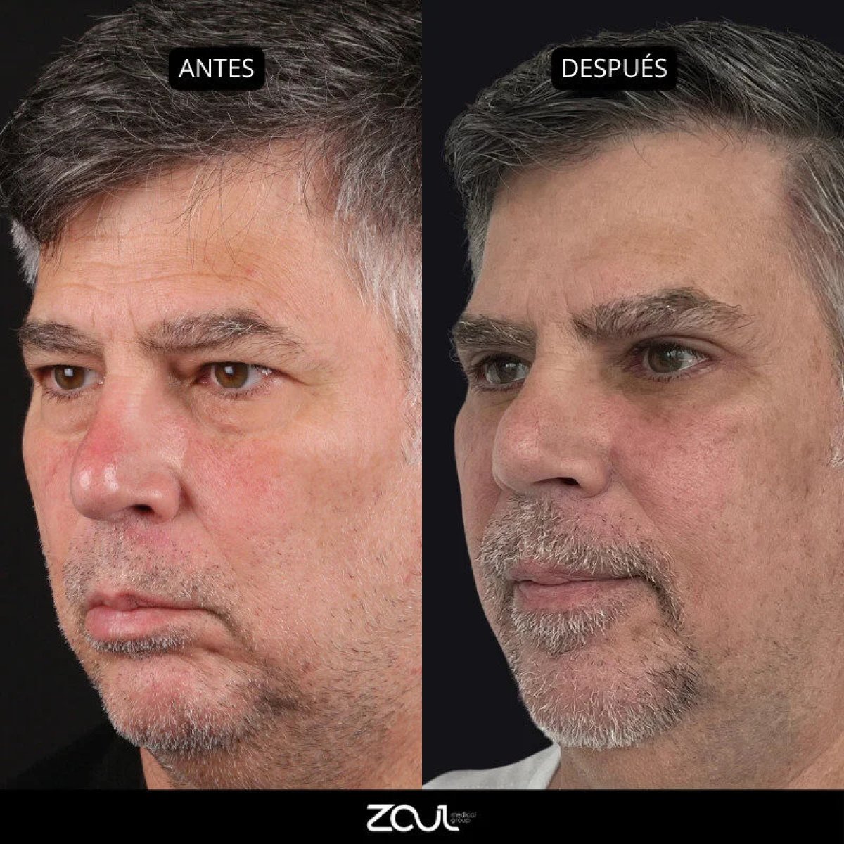 before and after photo