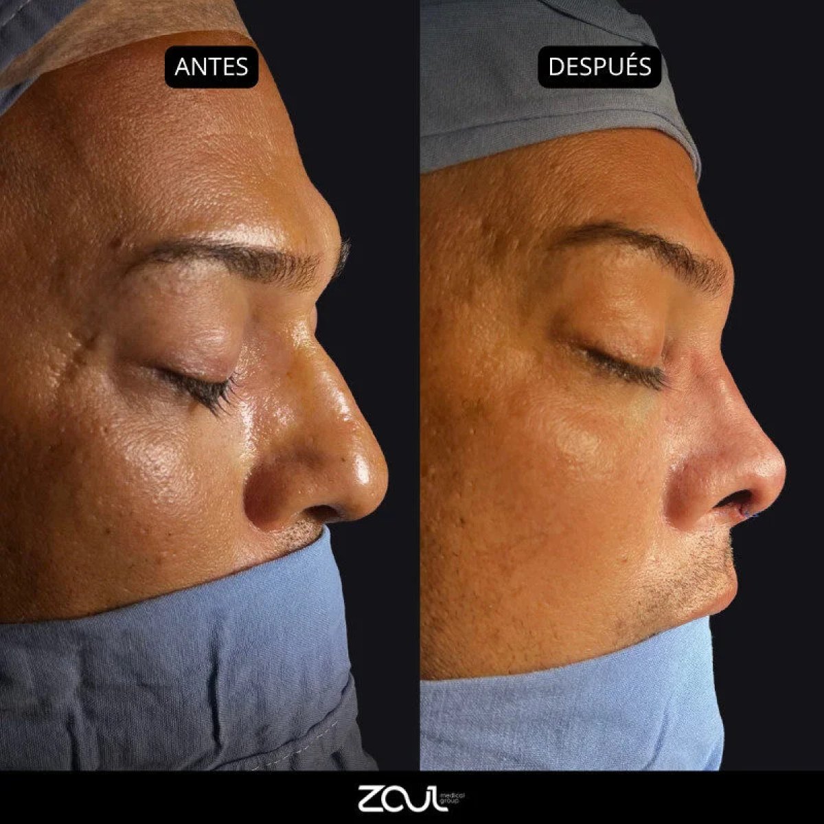 before and after photo