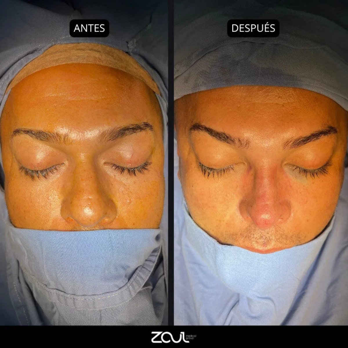 before and after photo