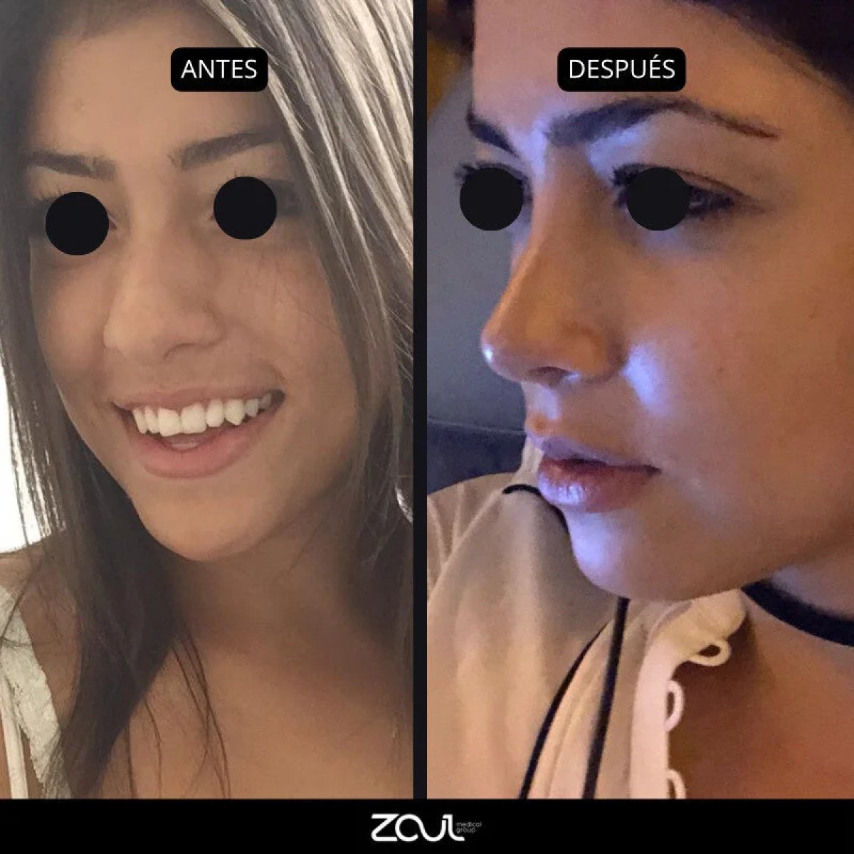 before and after photo