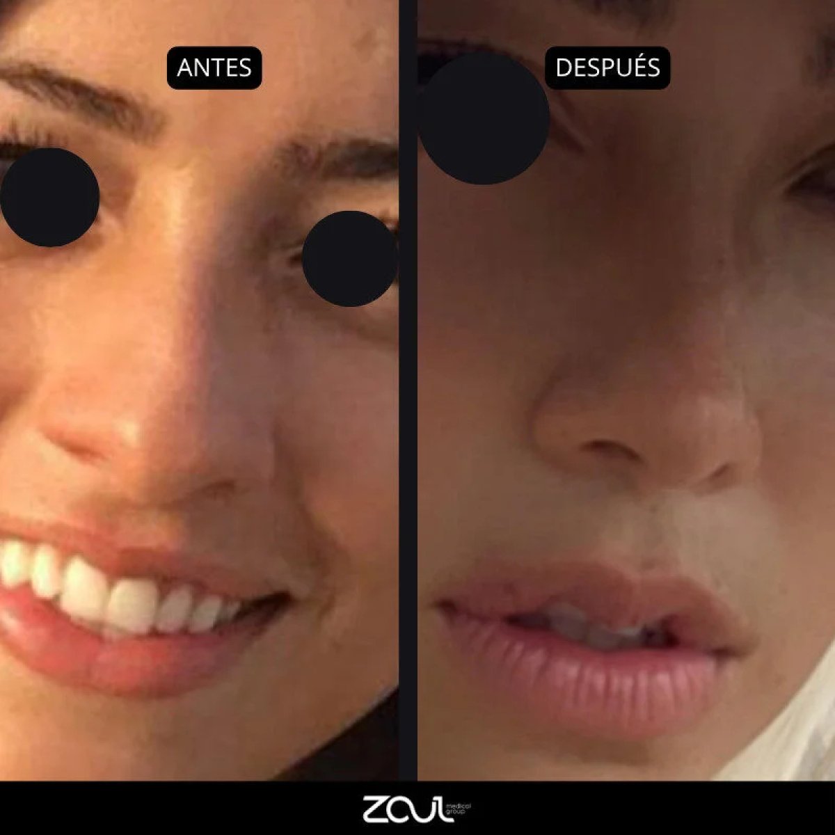 before and after photo