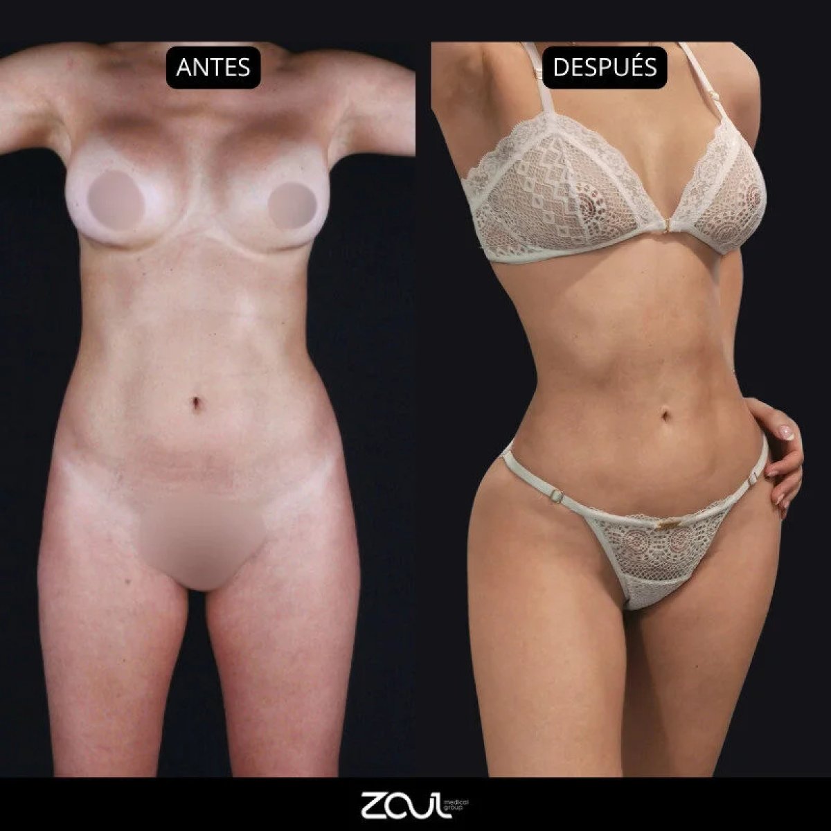 before and after photo