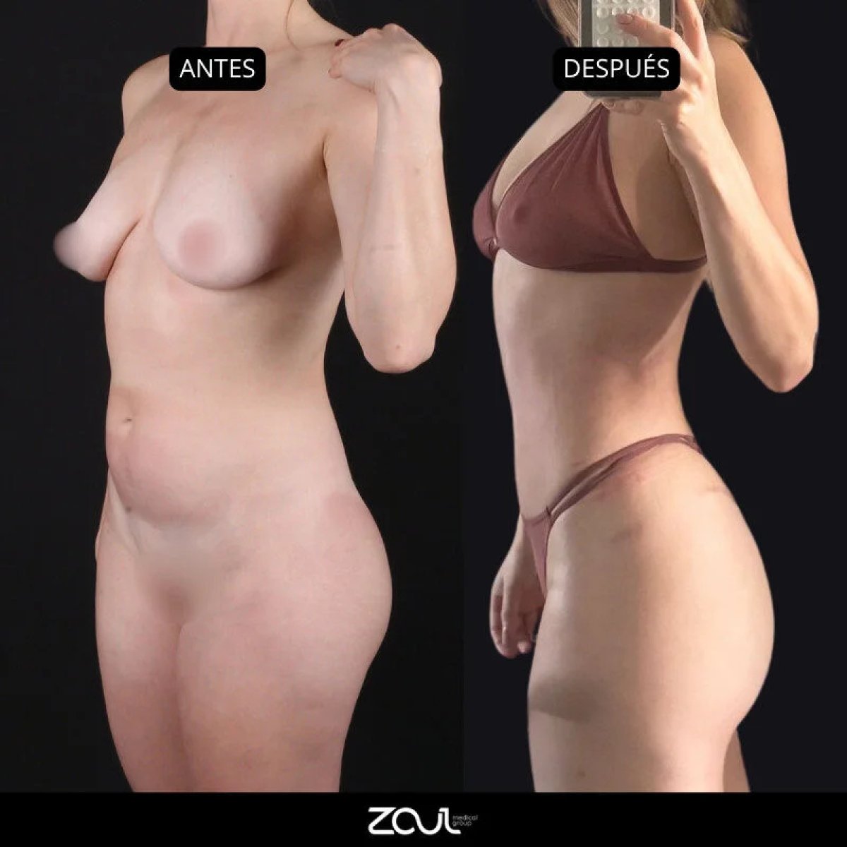 before and after photo