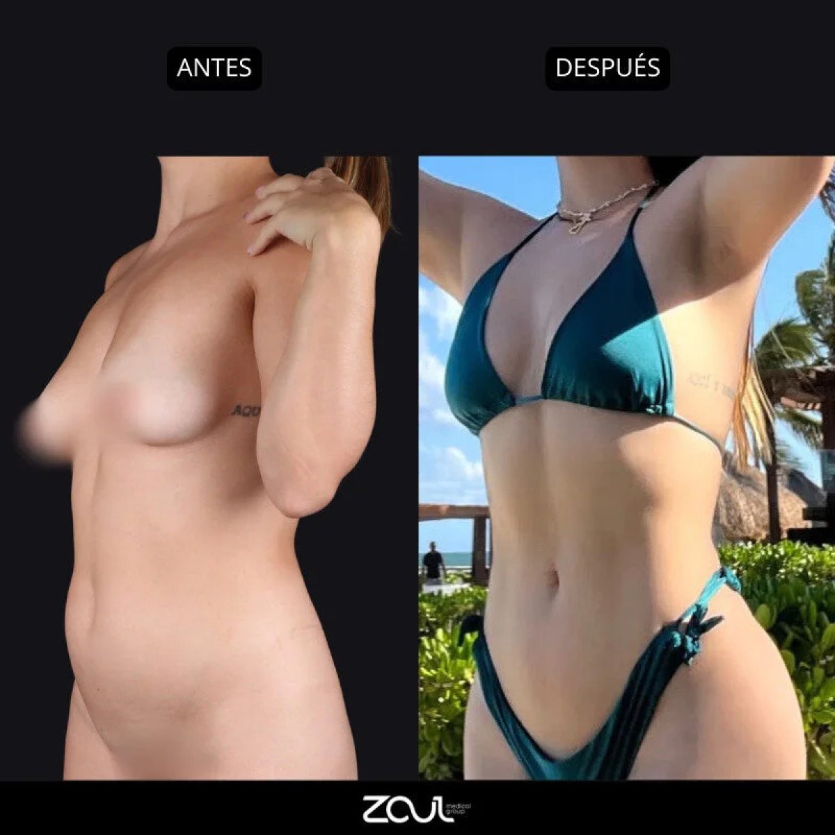 before and after photo
