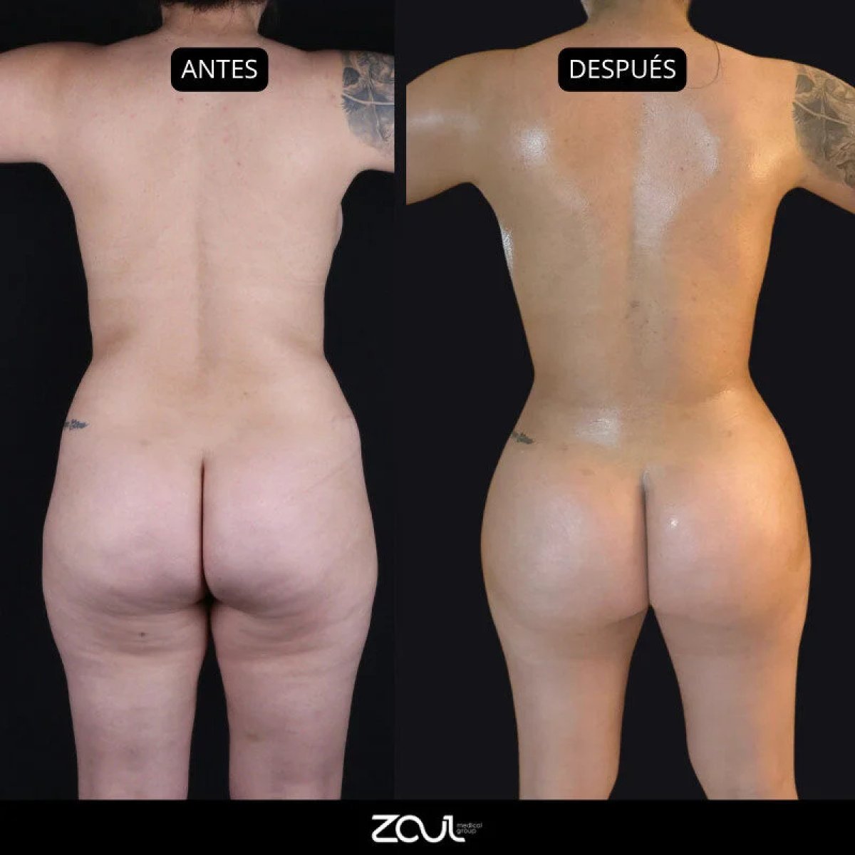before and after photo