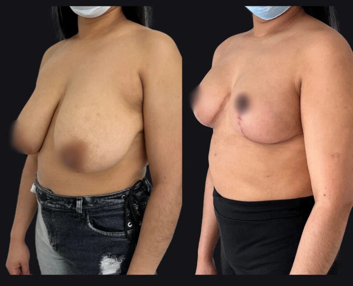 before and after photo