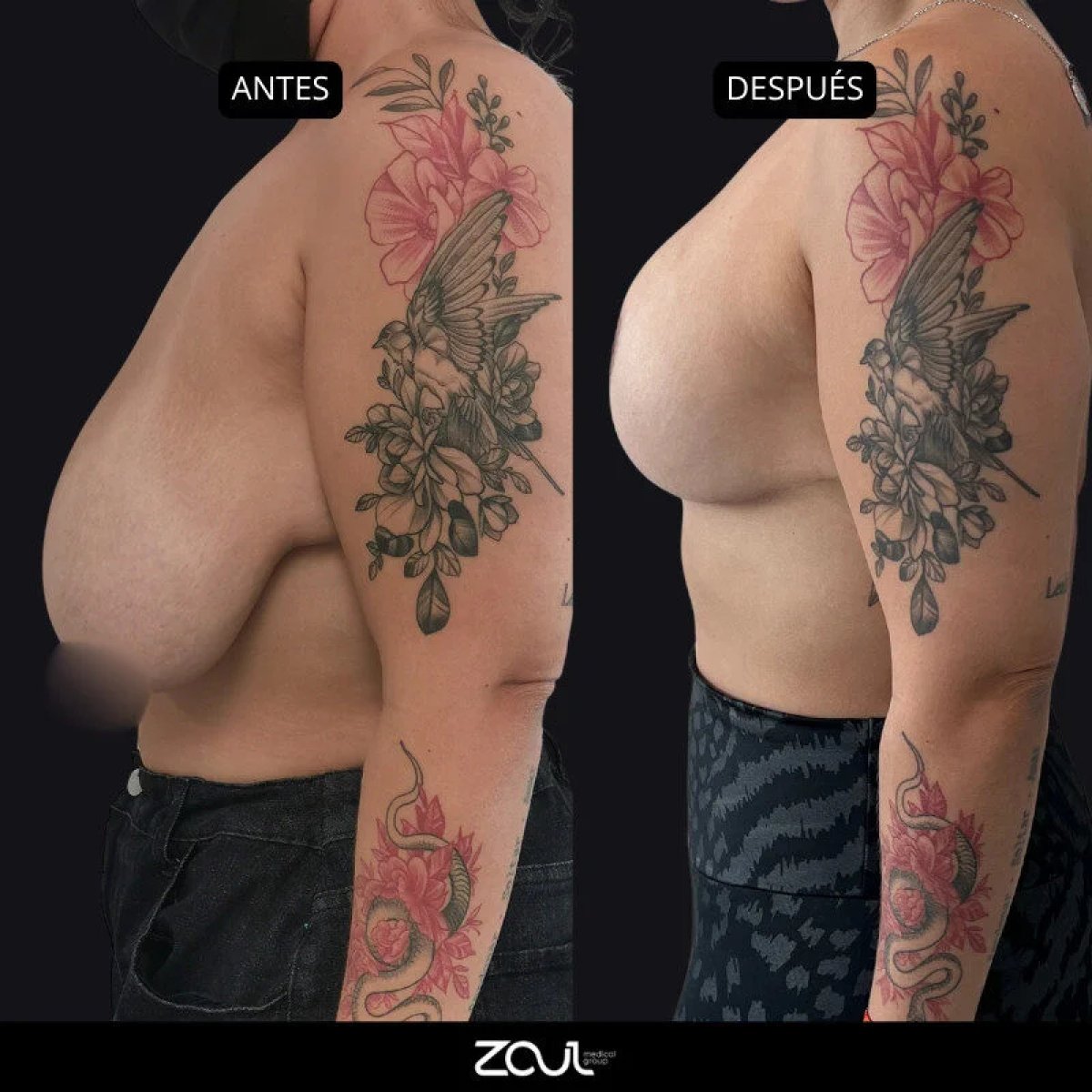 before and after photo