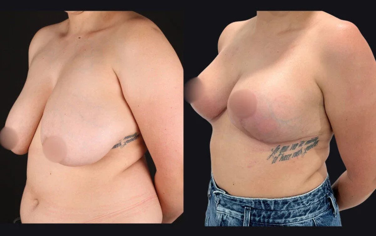 before and after photo