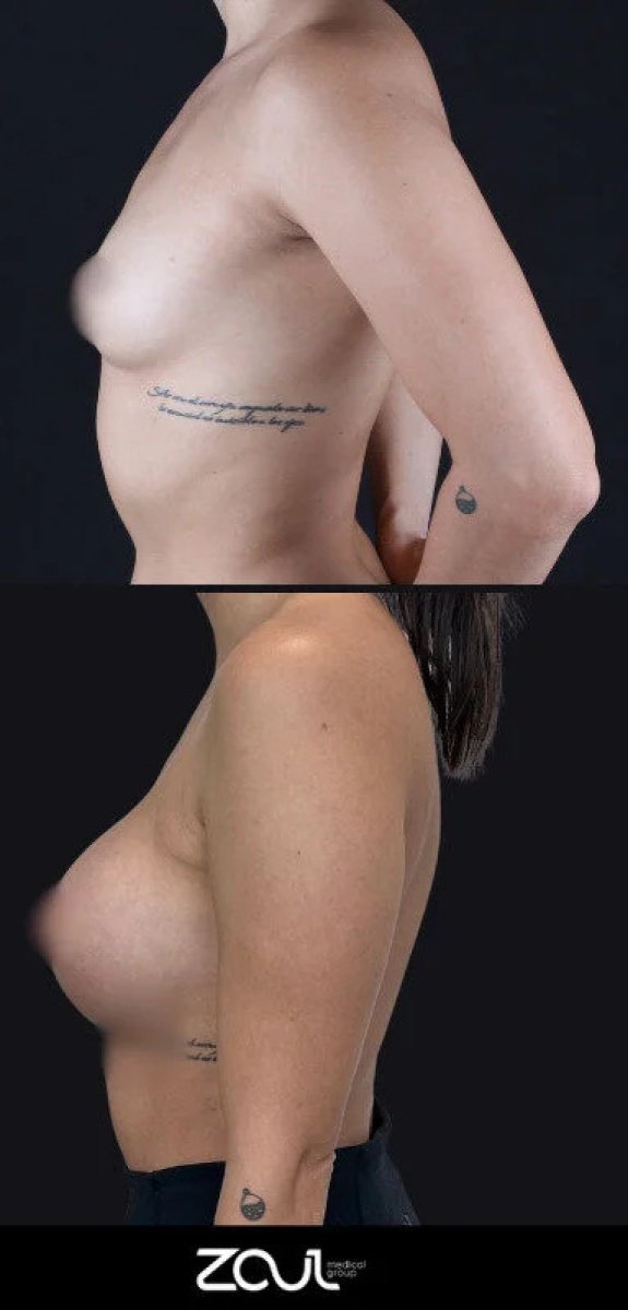 before and after photo