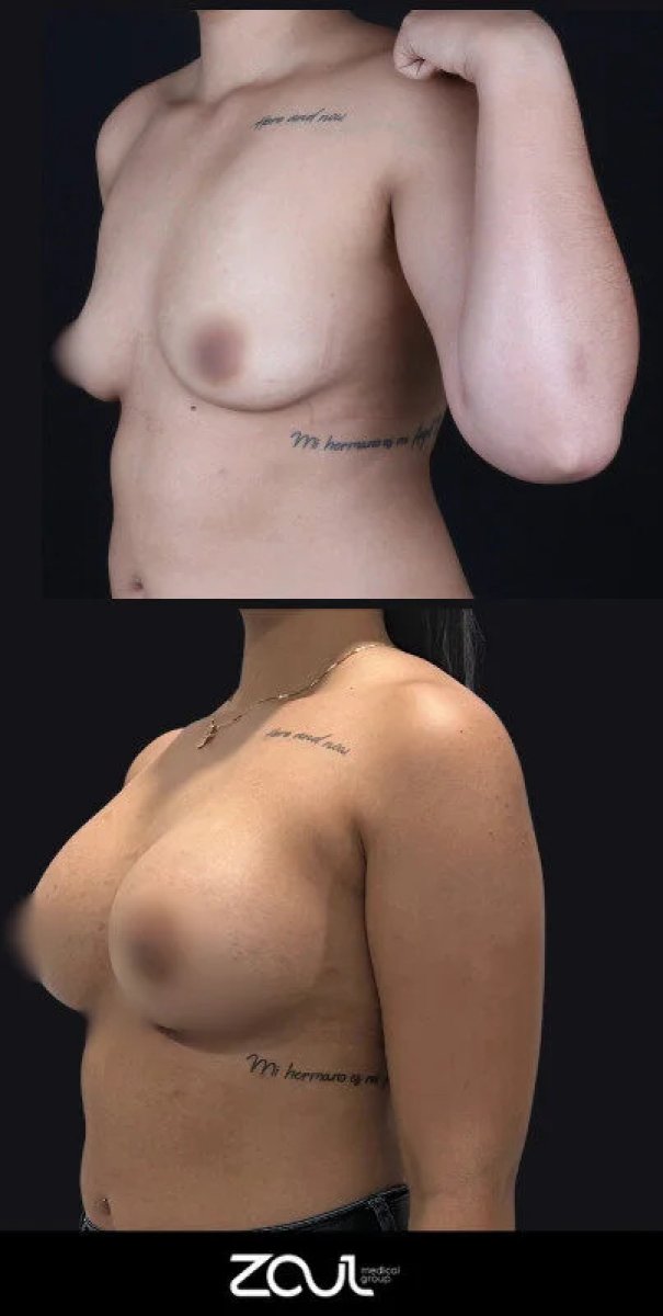 before and after photo