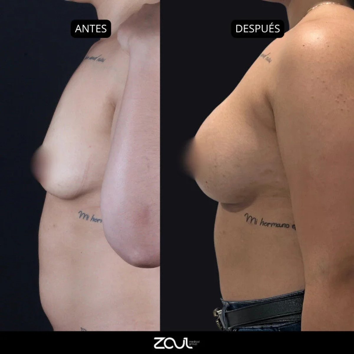 before and after photo