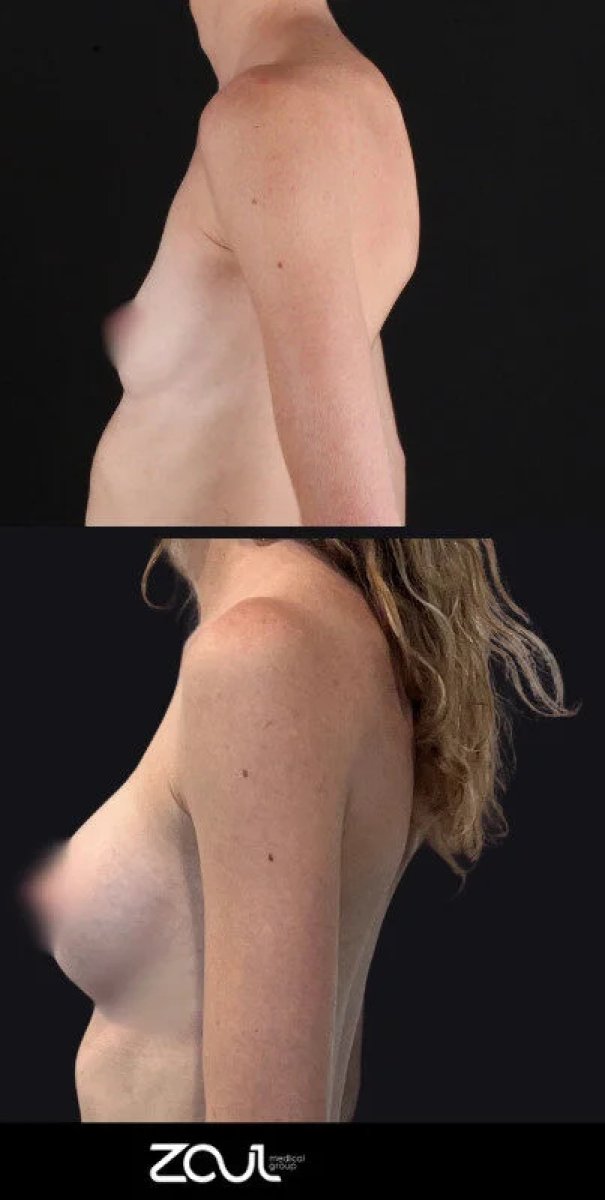 before and after photo