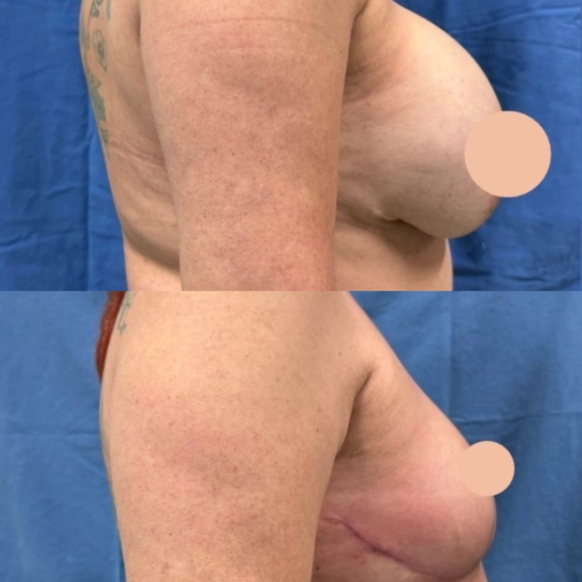 before and after photo