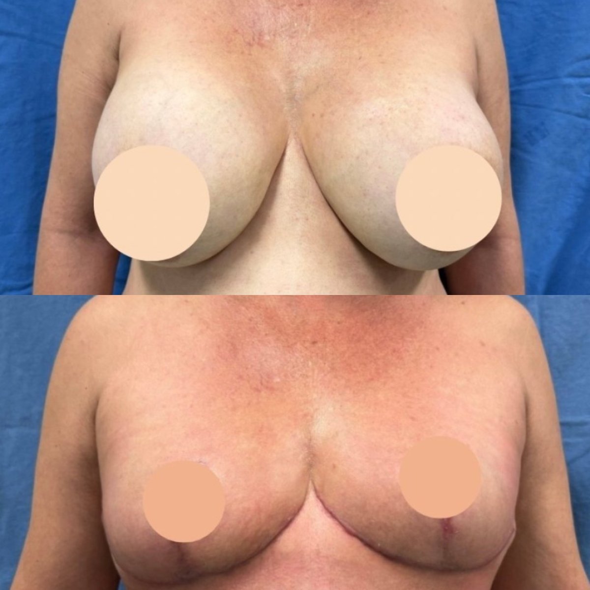 before and after photo