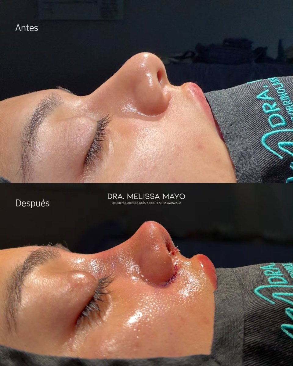 before and after photo