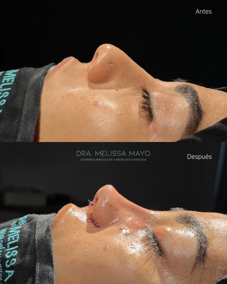 before and after photo