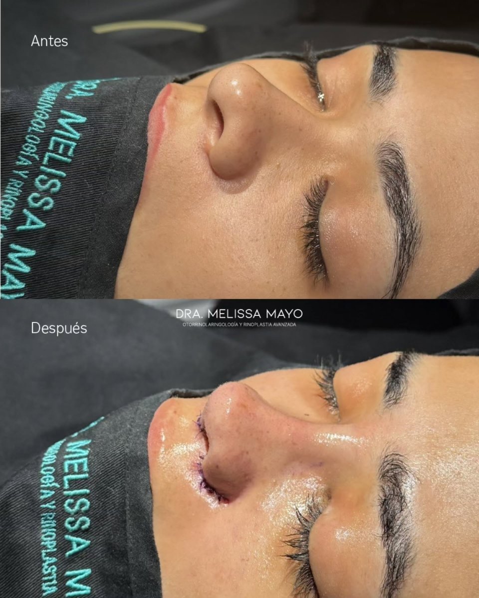 before and after photo
