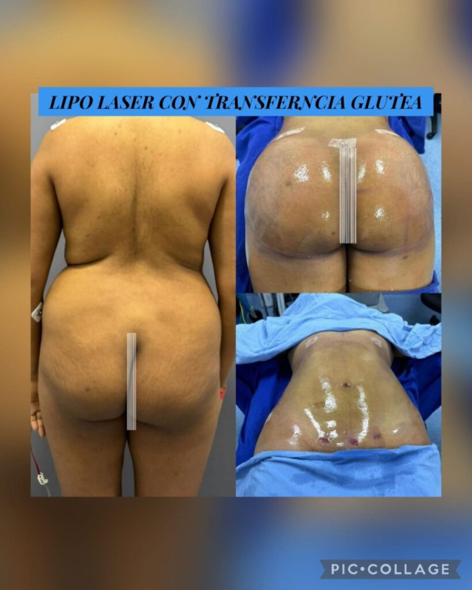 before and after photo
