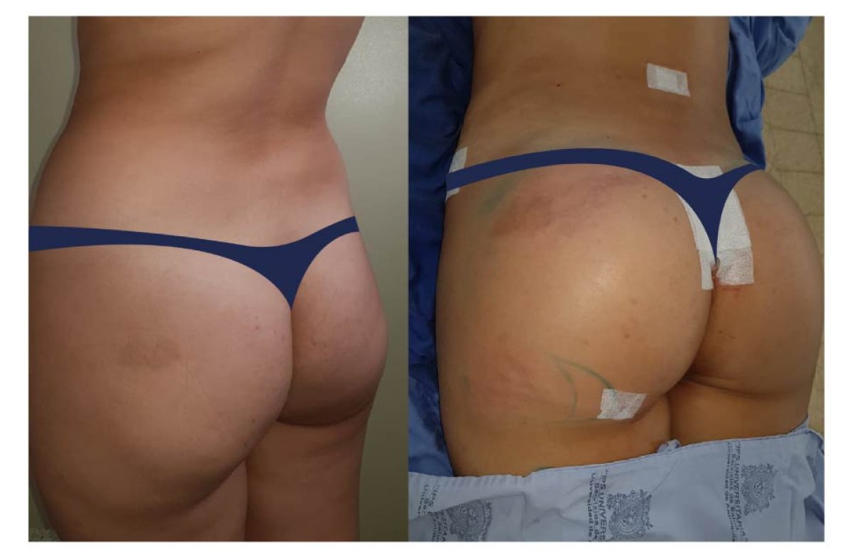 before and after photo