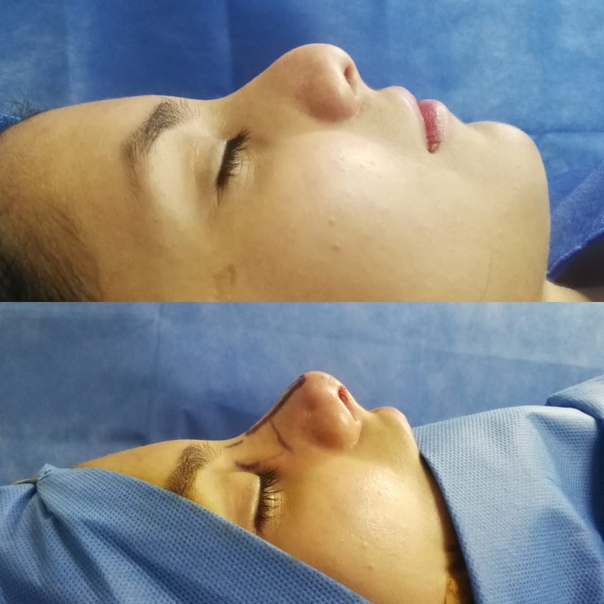 before and after photo