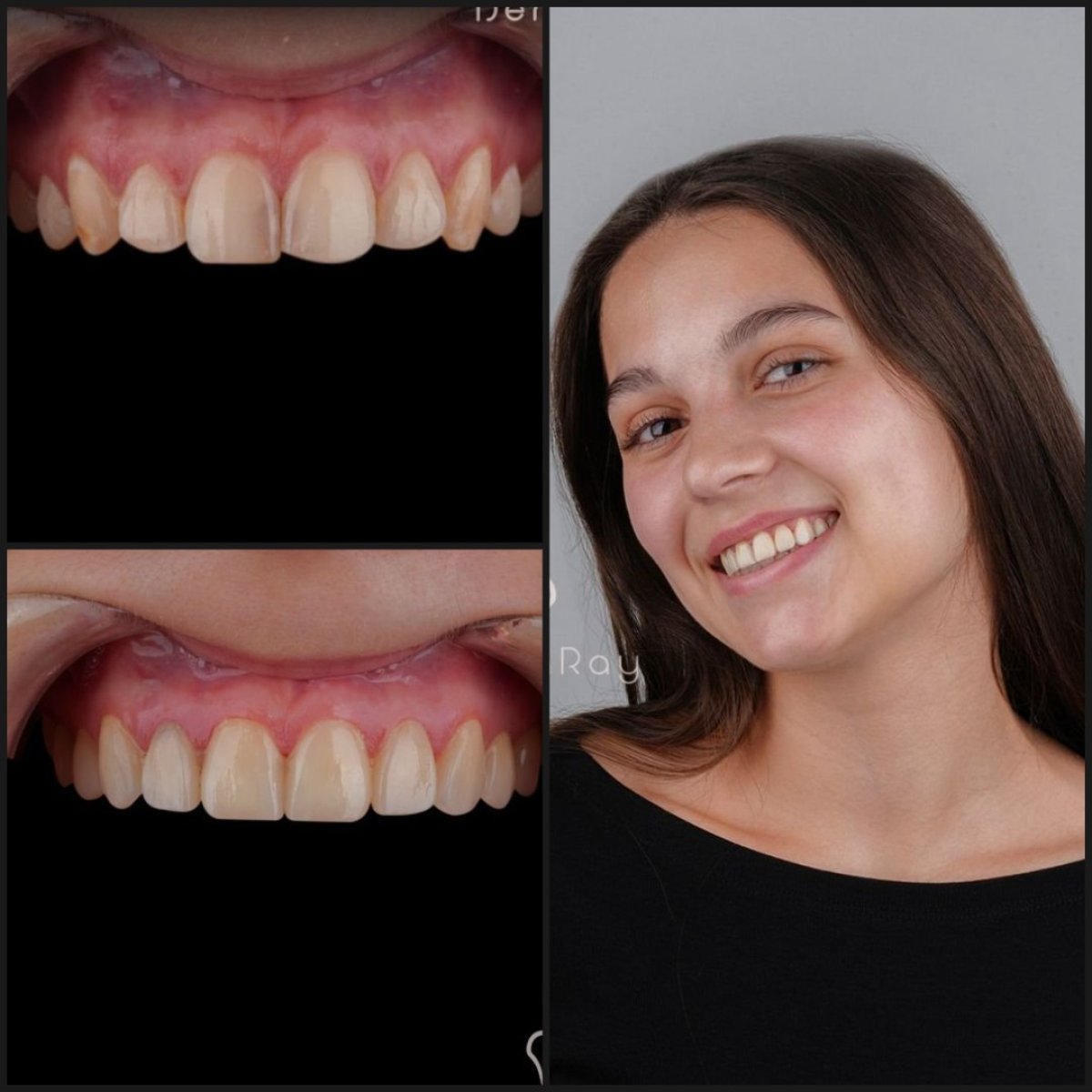 before and after photo